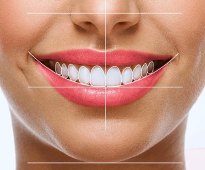 Digital Smile Designing Tirupati