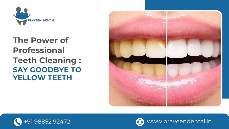 The Power of Professional Teeth Cleaning : Say Goodbye to Yellow Teeth